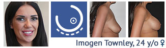 Breast Augmentation patient review