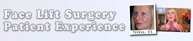 face lift patient review at Cosmetic Surgery Partners London