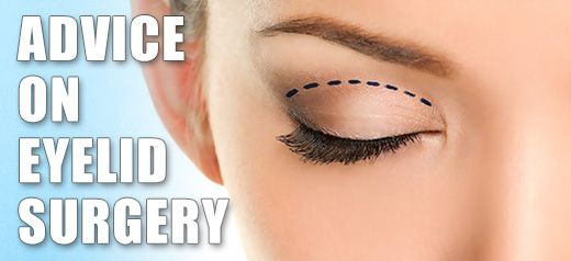 Eyelid surgery advice Blepharoplasty