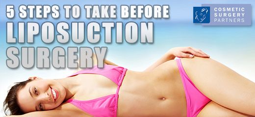 Five important steps to take before liposuction surgery