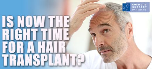 Is now the right time for a hair transplant