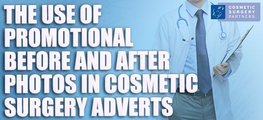 The proper use of before and after photos in cosmetic surgery advertising