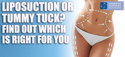 Tummy tuck vs liposuction surgery which is right for me