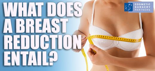 What Does Breast Reduction Surgery Entail