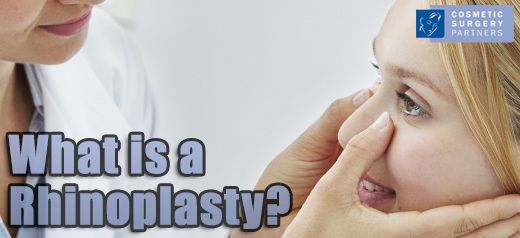 What is rhinoplasty