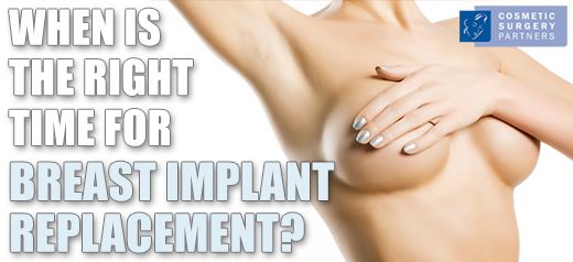 When should i replace my breast implants