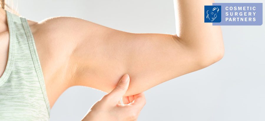Person pinching excess skin on upper arm before brachioplasty (arm lift) surgery – Cosmetic Surgery Partners logo in corner.