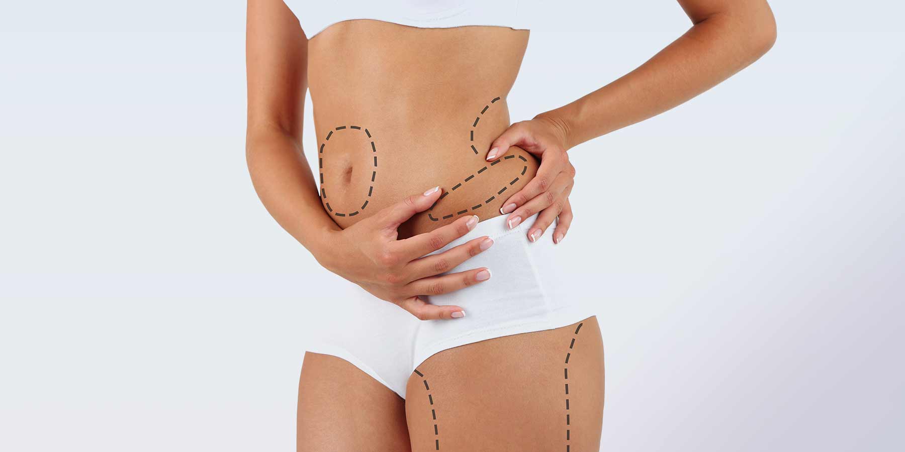 What Is the Difference Between Liposuction and a Tummy Tuck